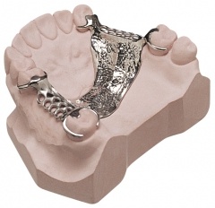 Implant dentures
